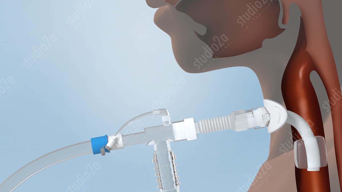 3d medical illustration rendering Chicago